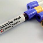 Brasil y Cuba son los países más afectados por el actual brote del virus Oropouche en la región